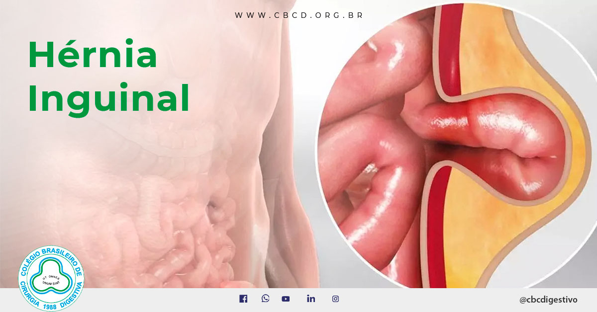 Anatomia Da Regiao Da Virilha