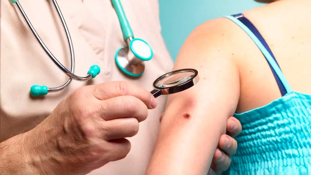 medico-examina-melanoma-20110524-original5.webp