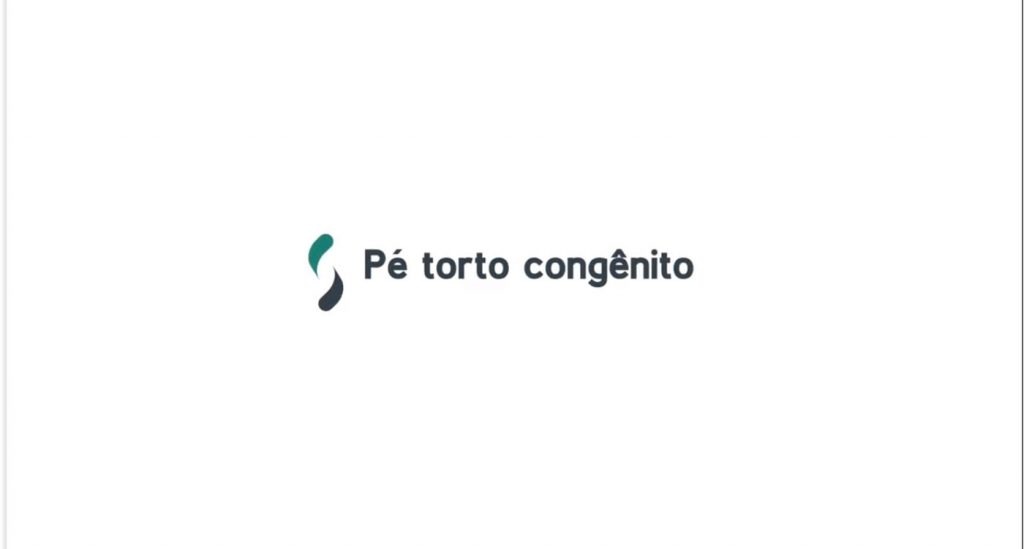 Pergunte à SBOT: pé torto congênito