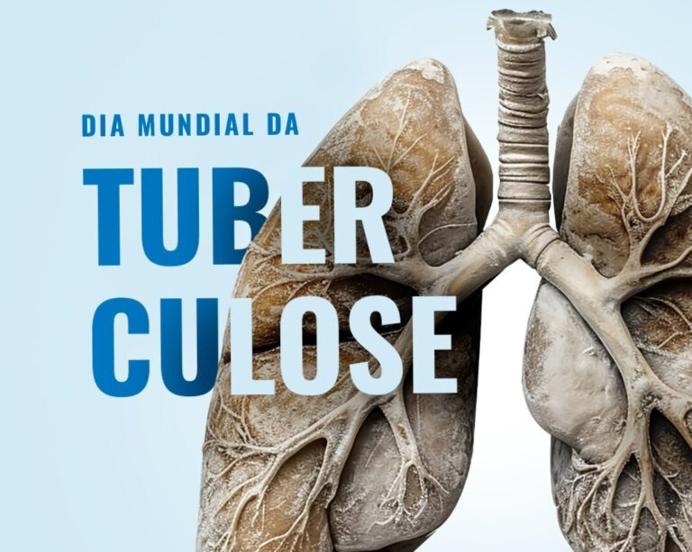 24 de março: SBPT alerta para avanço da tuberculose e reforça diagnóstico precoce